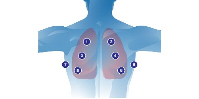 Diagramm Auskultation der Lungen
